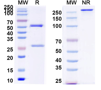 IL6 Human Monoclonal Antibody