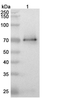 GPC3 Human Monoclonal Antibody