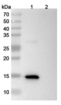 Neisseria meningitidis NHBA/Dextranase Human Monoclonal Antibody
