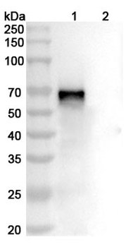 GPC3 Human Monoclonal Antibody