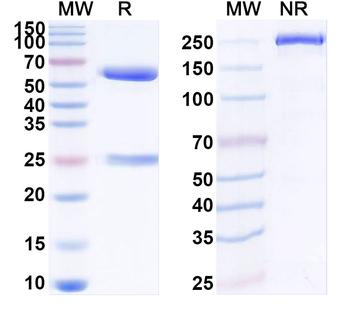 KARS1/Lysyl-tRNA synthetase Mouse Monoclonal Antibody