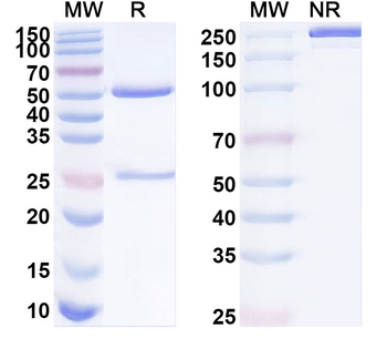 TMCC3 Mouse Monoclonal Antibody