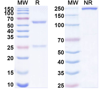 FXYD5/dysadherin Mouse Monoclonal Antibody