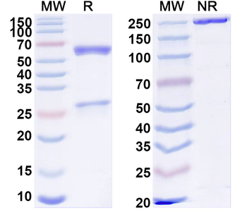SCN11A Mouse Monoclonal Antibody