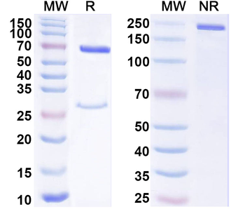 S100A9 Mouse Monoclonal Antibody
