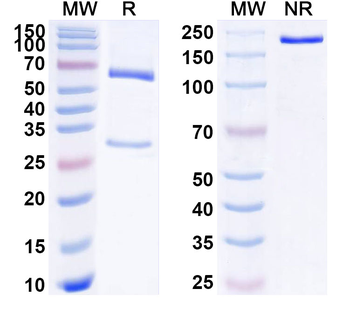 ADGRB1/BAI1 Mouse Monoclonal Antibody