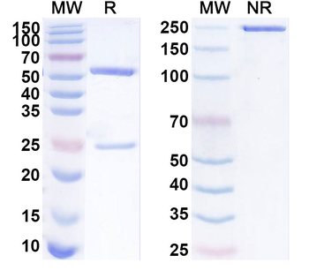 TRBC2 Mouse Monoclonal Antibody