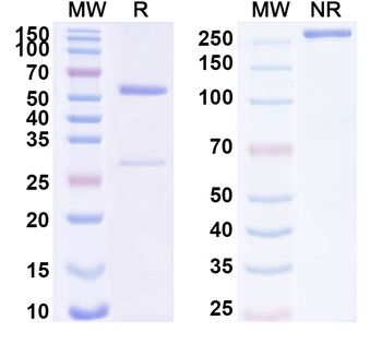 MOSPD2 Mouse Monoclonal Antibody