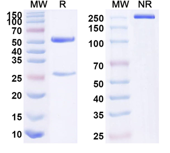 PTN Mouse Monoclonal Antibody