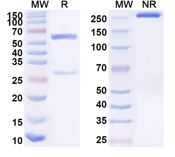 WT1 Mouse Monoclonal Antibody