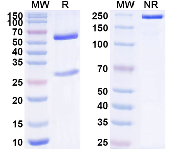 S100A8 Mouse Monoclonal Antibody