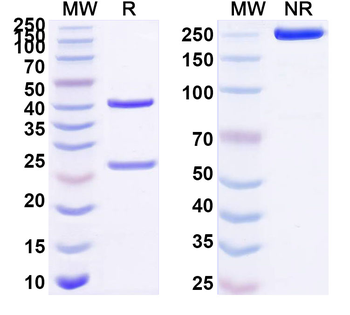 PLXNB1 Mouse Monoclonal Antibody