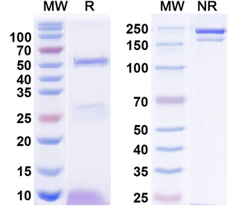 HTRA1/PRSS11 Human Monoclonal Antibody