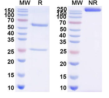 Influenza A virus HA/Hemagglutinin Human Monoclonal Antibody