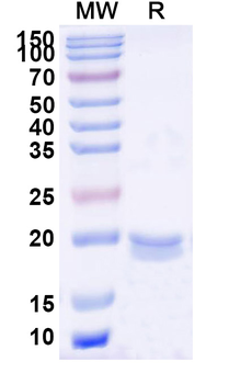 Clostridium botulinum BoNT/B Camelus Monoclonal Antibody