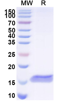 Clostridium botulinum BoNT/B Camelus Monoclonal Antibody
