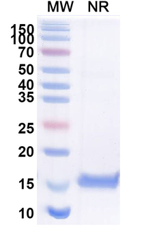Vibrio cholerae serotype O1 higB-2 Camelus Monoclonal Antibody