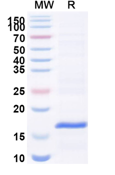 Vibrio cholerae serotype O1 higB-2 Camelus Monoclonal Antibody