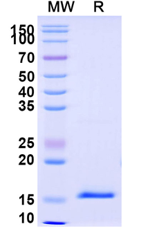 Vibrio cholerae serotype O1 higB-2 Camelus Monoclonal Antibody