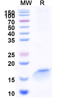 Vibrio cholerae serotype O1 higB-2 Camelus Monoclonal Antibody