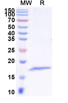 Clostridium tetani tetX/Tetanus toxin Camelus Monoclonal Antibody