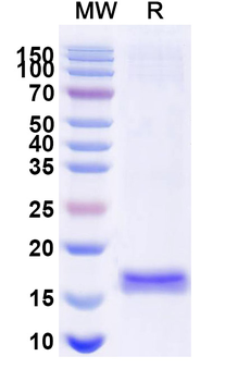 Porphyromonas gingivalis porM Camelus Monoclonal Antibody