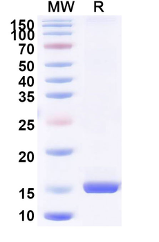 Porphyromonas gingivalis porM Camelus Monoclonal Antibody