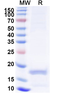 Porphyromonas gingivalis porM Camelus Monoclonal Antibody