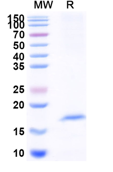 Vibrio cholerae serotype O1 ctxB/Cholera Toxin Subunit B Camelus Monoclonal Antibody