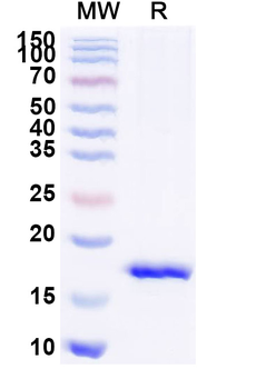 Staphylococcus aureus entB/SEB Camelus Monoclonal Antibody