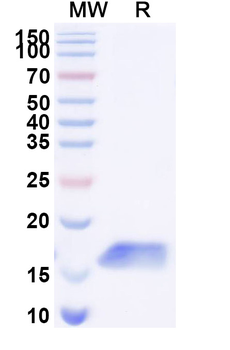 Clostridium botulinum botA/BOTOX Camelus Monoclonal Antibody