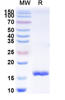 Clostridium botulinum botA/BOTOX Camelus Monoclonal Antibody