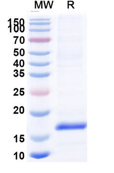 Clostridium botulinum botA/BOTOX Camelus Monoclonal Antibody