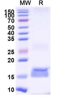 Clostridium botulinum botA/BOTOX Camelus Monoclonal Antibody