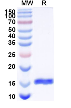 Clostridium botulinum botA/BOTOX Camelus Monoclonal Antibody