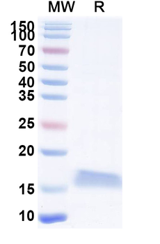Clostridium botulinum botA/BOTOX Camelus Monoclonal Antibody