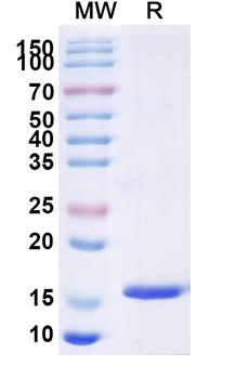 Clostridium botulinum botA/BOTOX Camelus Monoclonal Antibody