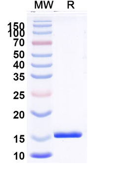 Clostridioides difficile Toxin B/tcdB Camelus Monoclonal Antibody