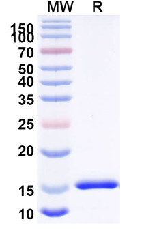 Clostridioides difficile Toxin A/tcdA Camelus Monoclonal Antibody