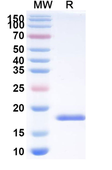 HCMV/HHV5 HHRF3/US28 Camelus Monoclonal Antibody