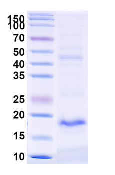 TREM2 Camelus Monoclonal Antibody