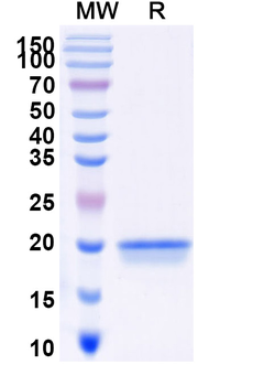CD167b/DDR2 Camelus Monoclonal Antibody