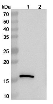 LYZ Human Monoclonal Antibody