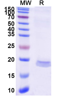 CCL2/MCP-1 Camelus Monoclonal Antibody