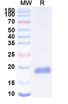 VIM/Vimentin Camelus Monoclonal Antibody