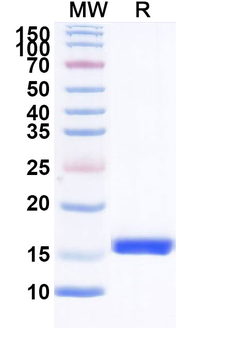 AZT/Aztreonam Camelus Monoclonal Antibody