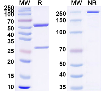 Clostridium tetani tetX/Tetanus toxin Human Monoclonal Antibody