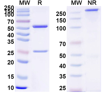 Clostridium tetani tetX/Tetanus toxin Human Monoclonal Antibody