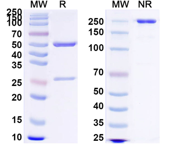 Clostridium tetani tetX/Tetanus toxin Human Monoclonal Antibody
