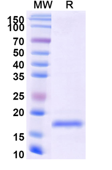 Vibrio cholerae higB-2 Camelus Monoclonal Antibody